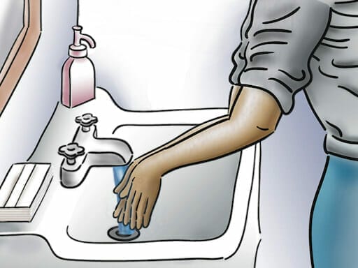 Permanent Pacemaker Implantation - Image 3