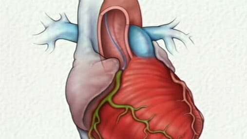 Cardiac Catheterization (Angiography) - Image 2